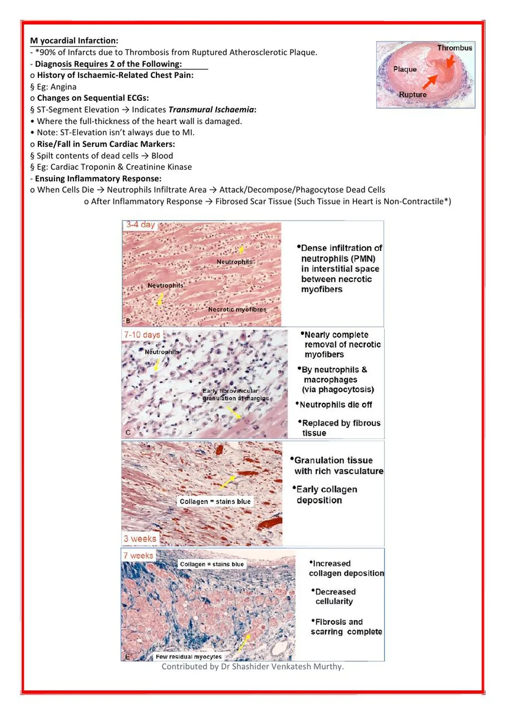 Cardiac Pathology