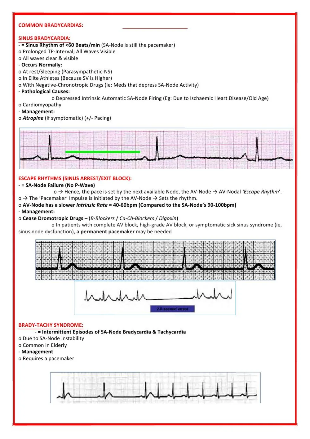 Heart Failure Mechanisms